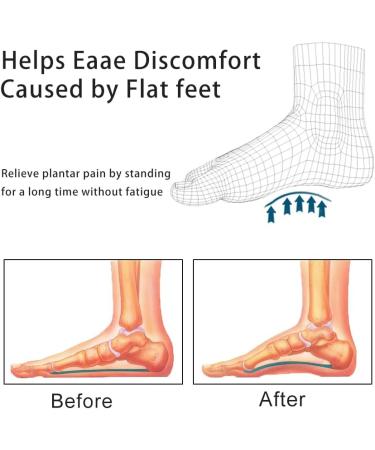 Correct-Position Arch Support Insoles for Flat Feet - Gel Inserts for Plantar Fasciitis - Adhesive Arch Pads for Pain Relief (Clear, Pack of 12) - Buy Online on GoSupps.com