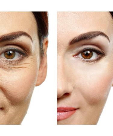 Anti-Aging Eye Gel for Dark Circles, Puffiness, Wrinkles & Skin Firming - Hyaluronic Acid & Aloe Vera - 1.7 fl. oz - Buy Online on GoSupps.com