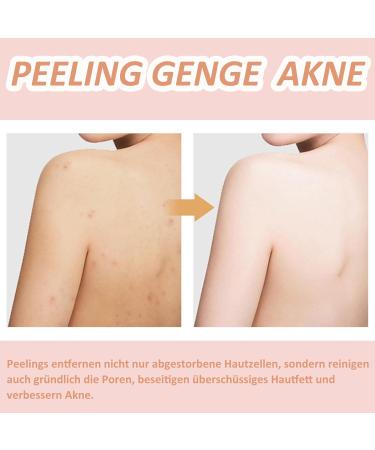 MEITREND Kojis ure K rperpeeling Kojic Acid Body Scrub 350 g exfoliating scrub removes dark spots dead skin and acne deep cleansing and body care for armpits and bikini zone - Buy Online on GoSupps.com