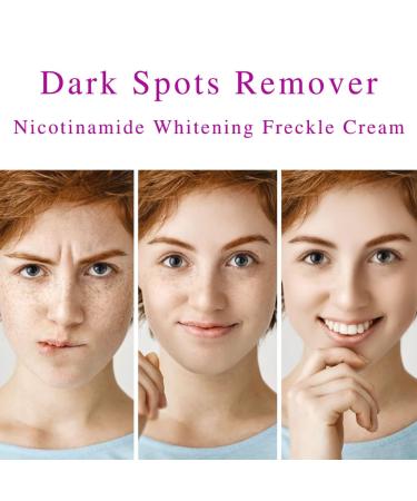 Dark Spot Remover for Face - Nicotinamide Whitening Cream for Melasma & Hyperpigmentation | Visible Results in 28 Days - 0.7 oz - Buy Online on GoSupps.com