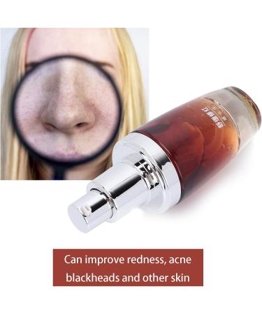 Soothing Serum for Redness Skin Comforting Serum for Sensitive Skin Anti-Redness Face Serum Gentle Soothing Face Serum Redness Care Serum for Sensitive Skin - Buy Online on GoSupps.com