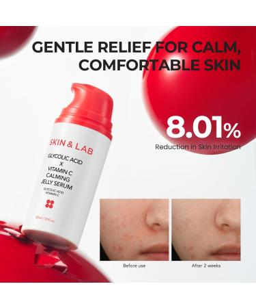  SKIN&LAB GLYCOLIC ACID X VITAMIN C CALMING JELLY SERUM 1.01 fl. oz. - Buy Online on GoSupps.com
