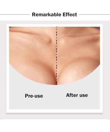 XSQD 5 Pcs Chest Wrinkle Pads - Silicone Anti Wrinkle Patches for Smooth Skin - T-shape Design for Preventing and Tightening Wrinkles - Buy Online on GoSupps.com