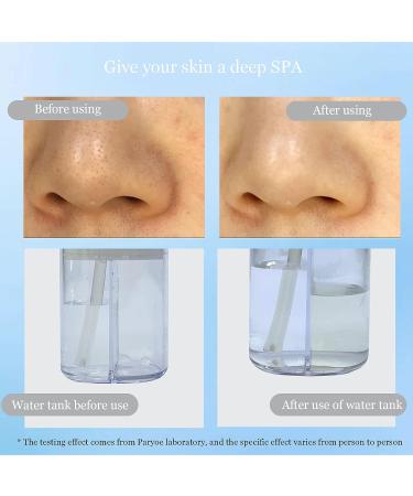 USB Rechargeable Blackhead Vacuum Pore Cleaner | Facial Cleansing Machine with Moisturizing Bubble Cleanser | 3-Speed Modes & 4 Probes - Buy Online on GoSupps.com