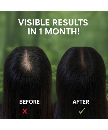  SONGVISON Nature Triangle Solid Shampoo for Women & Men - Eco Friendly Natural Solid Shampoo with Herbal Extracts to Soothe Scalp Strengthen Hair & Reduce Frizz - Buy Online on GoSupps.com