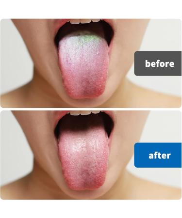 WT Stainless Steel Tongue Cleaner Scraper - Fresh Breath Oral Care Tool with Metal Box - Buy Online on GoSupps.com