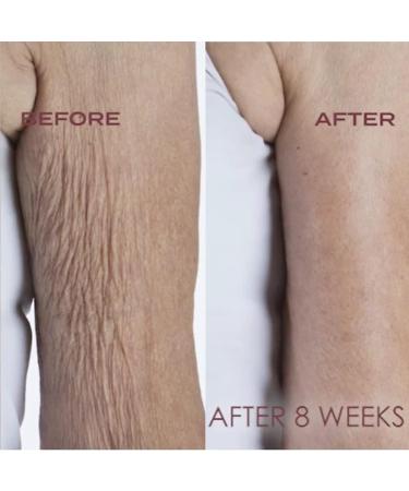 Crepe Erase Advanced Body Repair Treatment 10oz - Anti-Aging Wrinkle Cream for Face & Body - Boosts Elastin & Collagen - Original Citrus - Buy Online on GoSupps.com