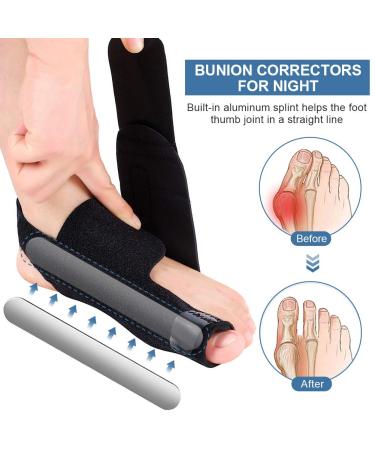 Adjustable Hallux Valgus Correction Rail | Orthopedic Bunion Night Splint for Pain Relief | 1 Pair - Buy Online on GoSupps.com