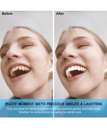XZLZMD Pebble Gel Dental Prostheses - Natural Color Temporary Teeth for Men & Women | 3 Pairs - Immediate Repair for Cracked or Missing Dentures - Buy Online on GoSupps.com
