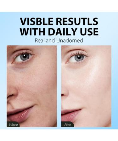 Pure Hyaluronic Acid Face Serum Hydrating Deep Moisturizing Firming Daily Facial Serum with Vitamin C & E Hydrating Solution for Dry Skin Wrinkles Fine Lines -All Skin Types (30ml/1 fl oz) - Buy Online on GoSupps.com