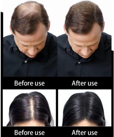 1BAG Hair Building Fibers Instant Hair Loss Treatment Color Powder Conceal Thinning Hair Add Volume For Both Men & Women(Black)  - Buy Online on GoSupps.com