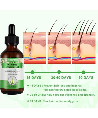 Pure Rosemary Oil for Hair Growth & Skin Care | Nourish Beards & Eyelashes | 2.02 Fl Oz Essential Oil Kit - Buy Online on GoSupps.com