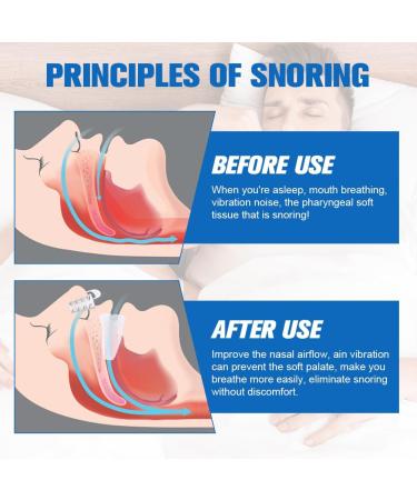 ACWOO Anti Snoring Devices Stop Snoring Devices Effective Snoring Solution Snore Stopper Reusable Stop Snoring Aids Snoring Sleeping Aid Device for Men and Women Restful Night's Sleep - Buy Online on GoSupps.com