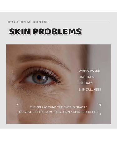 Retinol Eye Cream Dark Circle Eye Cream For Puffy Eyes Caffeine Eye Cream Anti Aging Eye Bags Remover And Anti Wrinkle Brightening Eye Cream Fine Lines Reduction Eye Contour Firming Eye Cream. - Buy Online on GoSupps.com