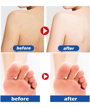 Hand and foot moisturizing cream skin hand and foot anti-freezing chapped peeling moisturizing and moisturizing body moisturizing cream unisex - Buy Online on GoSupps.com