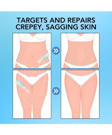 RENTANAC Luxelift Skin Firming Youth Butter Cream Luxelift Skin Firming Cream Skin Firming Body Butter Body Butter Anti Aging Moisturizer for Body Moisturizes Smoothing - Buy Online on GoSupps.com