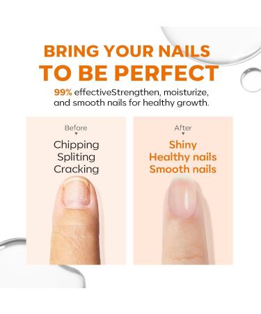 Modelones 15ml 8-in-1 Nail Strengthener & Ridge Filling Base Coat Nail Polish Repair Kit Nail Growth Treatment for Thin and Damaged Nails Clear - Buy Online on GoSupps.com