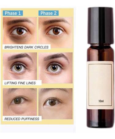 MAYFRI Zendi Time Eraser Zendi Time Eraser Roll-on Castor Oil and Frankincense for Eyes Bags under the Eyes Wrinkles - Buy Online on GoSupps.com