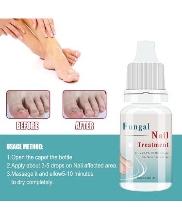3pcs Onyxoguard Nail Growth And Repair Serum Nail Growth And Strengthening Oil - Buy Online on GoSupps.com