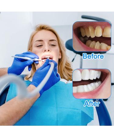 Buy Air Ice Teeth Set - 2 Pairs of Provisional Dentures & Cosmetic Veneers for Men & Women - Perfect Tooth Whitening Alternative - Buy Online on GoSupps.com