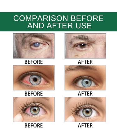 OVEALDGO Presbyopia VisionRestore Eye Drops | Effective Presbyopia Recovery Treatment | Nourish Eye Health | Buy 2 Boxes for Optimal Care - Buy Online on GoSupps.com