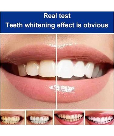 Shop Sopami SP-7 Probiotic Toothpaste & Toothbrush - Whitening Stain Removal Fresh Breath Deep Clean Care - International Shipping Available - Buy Online on GoSupps.com