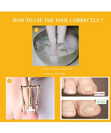 Ingrown Toenail Corrector & Thick Nail Clipper Set - Stainless Steel Heavy-Duty Tools for Podiatrist Treatment - Long Handle Pedicure Kit (10pcs) - Buy Online on GoSupps.com