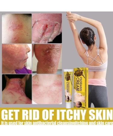 VEJIA Eczema Psoriasis Treatment Cream 20g - Dermatitis Pruritus Relief Ointment for Adults (3pcs) - Buy Online on GoSupps.com