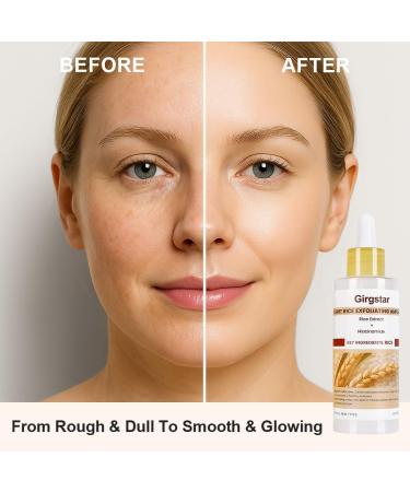 Peel Shot Glow White Rice Peeling Ampoule | Gentle Exfoliating Face & Body Peel to Instantly Remove Dead Skin Cells | Rice Extract for a Brighter Smoother Complexion | For All Skin Types (80ml) - Buy Online on GoSupps.com