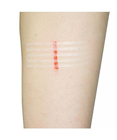Teqler Wound Seam Strips 3 x 75 mm - High-Quality Medical Tape for Optimal Healing - Fast International Shipping - Buy Online on GoSupps.com