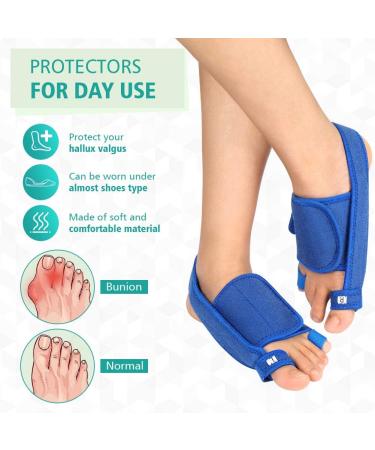 Hallux Valgus Rail - 3D Printed Bunion Splint with Arch Support | Nighttime Toe Straightener & Hammer Pain Relief - Buy Online on GoSupps.com