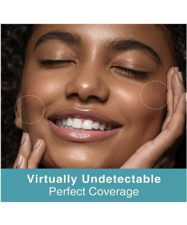 Acne Pimple Patch Master Patch - 144 Hydrocolloid Dots for Effective Blemish Treatment | International Shipping Available - Buy Online on GoSupps.com