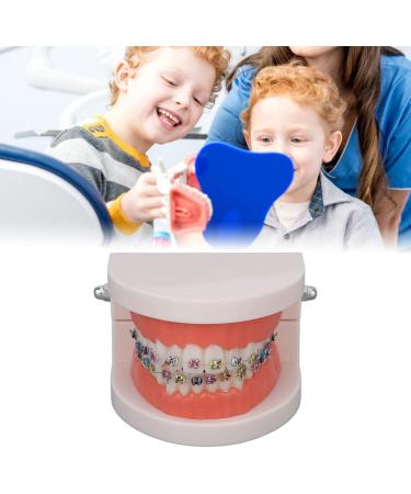 Tooth Demonstration Model - Dental Typodont with Orthodontic Bracket for Dentist Research | International Shipping - Buy Online on GoSupps.com