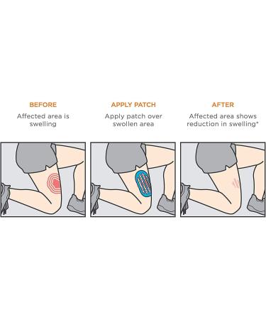 KT Tape Recovery Patch - Swelling Relief Tape for Rapid Recovery - Buy Online on GoSupps.com