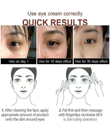 Magic Eye Cream - Anti Aging Treatment for Under Eye Bags, Wrinkles, Puffiness & Dark Circles - Buy Online on GoSupps.com