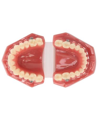 Orthodontic Demonstration Model for Dental Research | Metal Wires & Ceramic Brackets | Teaching Aids for Adults - Buy Internationally - Buy Online on GoSupps.com