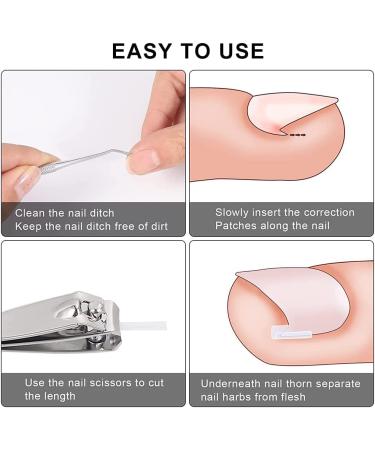 Toenail Corrector Patch Ingrown Nail Corrector Ingrown Nail Treatment Ingrown Nail Corrector Stickers Toenail Correction Toenail Patch - Buy Online on GoSupps.com