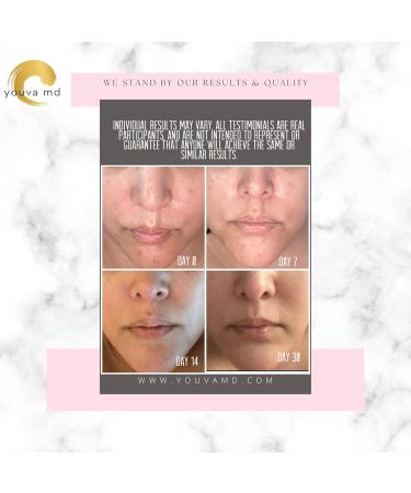 Physician-Formulated Anti-Aging Serum | CoQ10 Vitamin C E B3 Hyaluronic Acid | Wrinkles Acne Rosacea | 1 fl oz - Buy Online on GoSupps.com