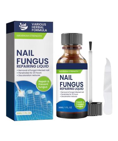 XPEX 30ml Foot Nail Repair Liquid Super Strong Nail Fungus Repair Solution For Repairing Nails And Toenails Protects Thick Damaged And Discolored Nails Includes Nail File