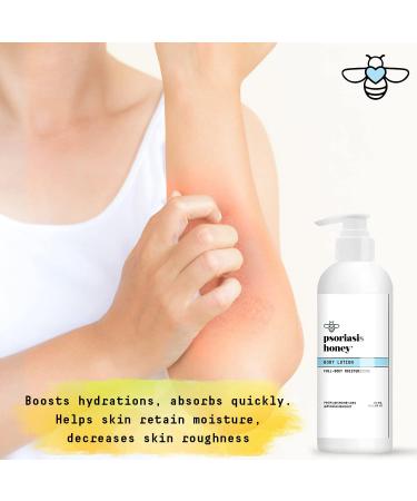PSORIASIS HONEY Daily Moisturizing Body Lotion with Aloe Vera, Olive Oil, Colloidal Oatmeal, and Mango Butter - 16oz - Buy Online on GoSupps.com
