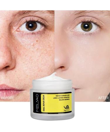 Snail Mucin 92% Moisturizer - Daily Repair Face Gel for Dry & Sensitive Skin | Paraben-Free Sulfate-Free Phthalate-Free | Korean Skincare | 1.76 oz - Buy Online on GoSupps.com