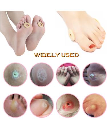 90 Piece Soft Latex Foam Corn Cushions - Self Adhesive Callus Pads for Foot and Heel Pain Relief - Skin Color, 2 Models - One Size - Buy Online on GoSupps.com