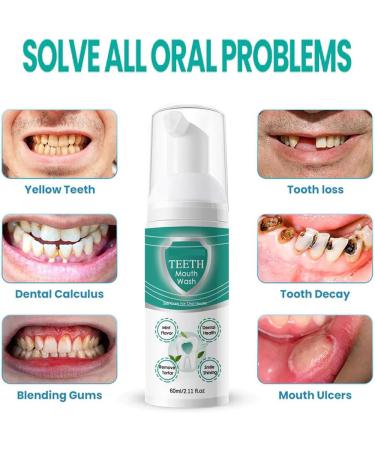 60ml AQA New Teeth Mouthwash | 360 Gum Care Whitens Teeth & Eliminates Bad Breath - 2PCS - Buy Online on GoSupps.com