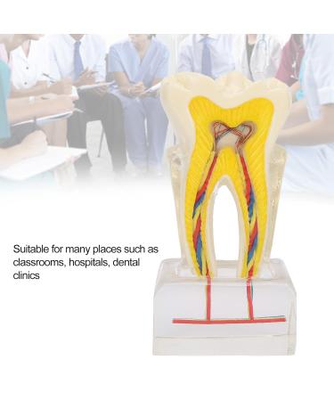 Professional Dental Nerve Model for Teaching | Resin Tooth Model for Students | International Shipping - Buy Online on GoSupps.com