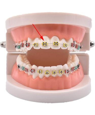 Orthodontic Ligature Rubber Bands - Multi-Color O-rings for Braces - Buy Online on GoSupps.com