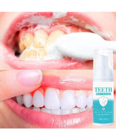 50ml Saveuppro Teeth Whitening Mousse Foam for Fresh Breath & Deep Cleaning - Travel Friendly & Easy to Use - Buy Online on GoSupps.com