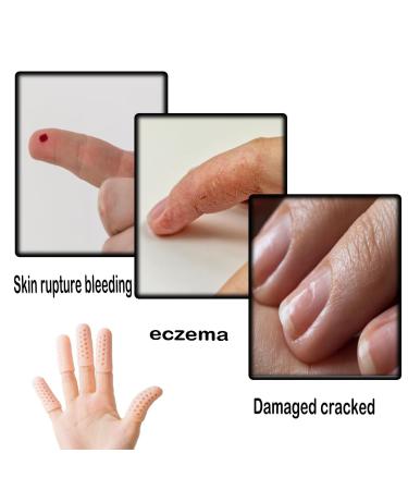 Neodtx Finger Protection Silicone - 12pcs Fingertip & Thumb Guards for Cracks Pain Arthritis Relief - Buy Online on GoSupps.com