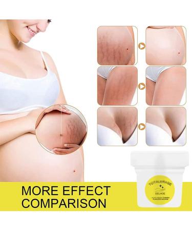 Organic Flawless Firming Cream & Turmeric Mousse for Stretch Marks - 30g (2 PCS) - Buy Online on GoSupps.com
