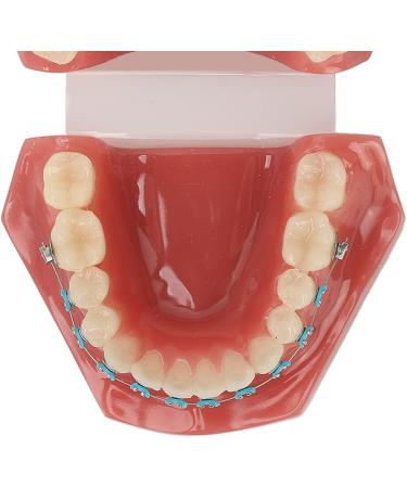 Orthodontic Model | 28 Partial Dental Resin Demonstration & Bracket Model for International Shipping - Buy Online on GoSupps.com