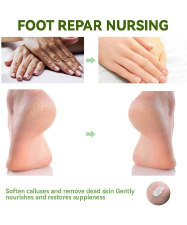 FOBOXCHD Salicylic Acid Hand and Foot Repair Cream Moisturizing Anti-Cracking Dead Skin Removal Hydrating and Repairing - Buy Online on GoSupps.com